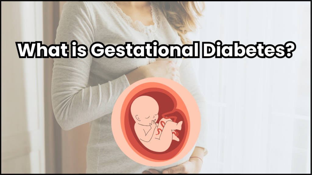 Gestational Diabetes: Everything You Need to Know 3 What is Gestational Diabetes