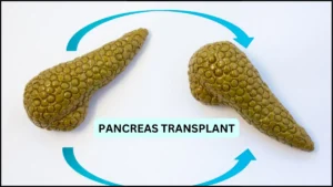 type 1 diabetes pancreas transplant
